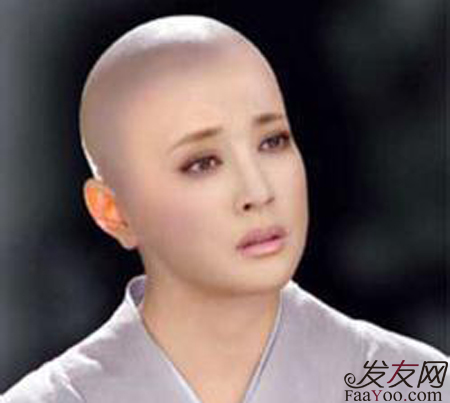 年輕男性脫發(fā)