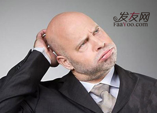 造成男人大量脫發(fā)的原因是什么呢？