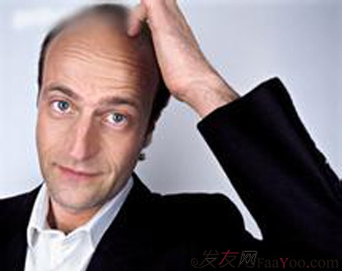 關(guān)于男性脫發(fā)的問題跟男性需了解的知識？