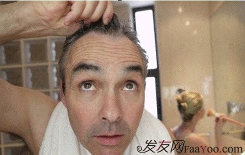 男性得了脫發(fā)應(yīng)該怎么辦好？