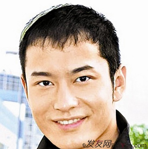 哪些原因能夠引起斑禿脫發(fā)？