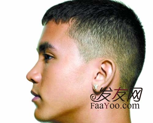  鬢角脫發(fā)怎么辦？使用米諾地爾有用嗎？