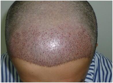 2月2日龍?zhí)ь^這天BLS 2500單位　