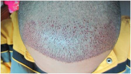 2月2日龍?zhí)ь^這天BLS 2500單位　