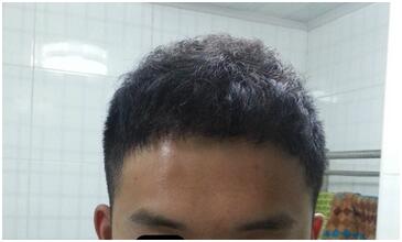 2月2日龍?zhí)ь^這天BLS 2500單位　