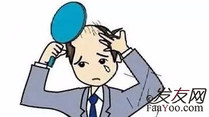 男性防止脫發(fā)需要每天洗頭嗎