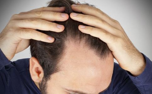 為什么男性比女性更容易脫發(fā)？