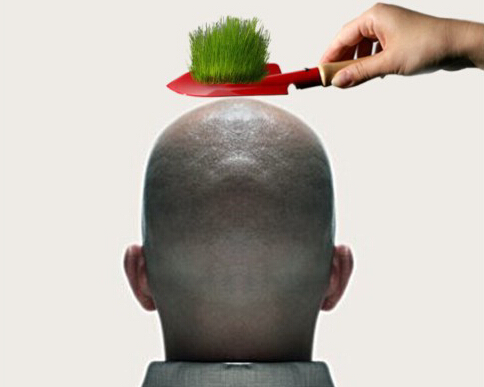 上海植發(fā)哪家醫(yī)院好