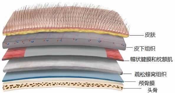 做植發(fā)要謹(jǐn)慎--做植發(fā)需要怎樣才能有保障