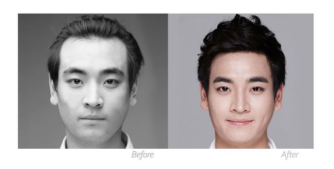 上海植發(fā)效果好的醫(yī)院有哪些，費用是多少？