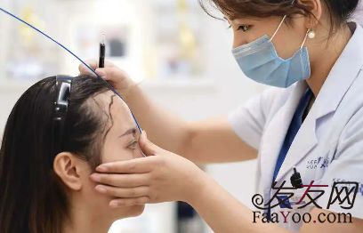 植發(fā)價(jià)格到底如何計(jì)算？記住這三個(gè)關(guān)鍵因素！