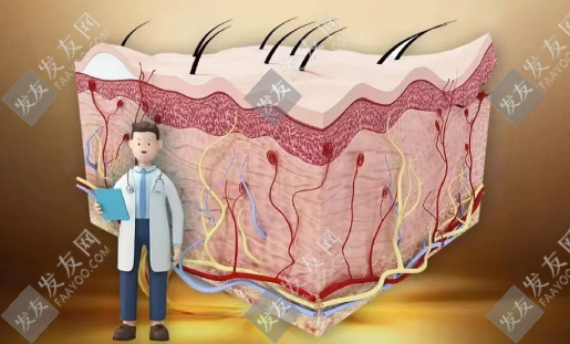 植發(fā)后為什么會(huì)出現(xiàn)毛囊炎？和哪些方面有關(guān)？