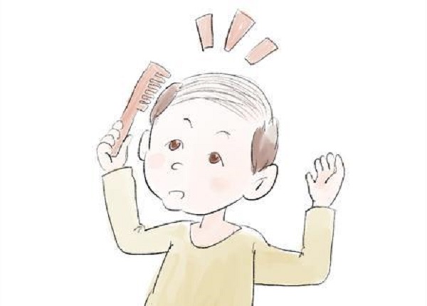 脫發(fā)嚴(yán)重應(yīng)該要怎么辦
