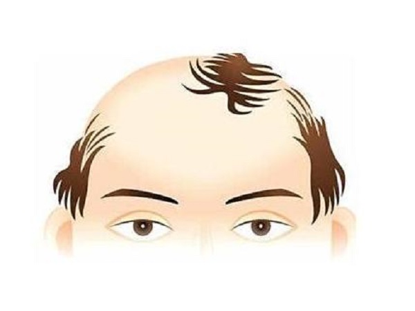 防脫發(fā)的小妙招