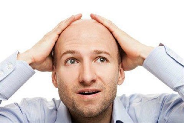 急性脂溢性脫發(fā)的原因是什么