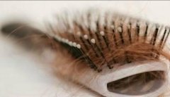 如何預(yù)防年輕人脫發(fā)！