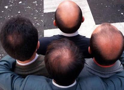 脂溢性脫發(fā)的特征表現(xiàn)