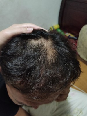 增發(fā)纖維使用的效果太棒了