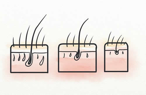 男性愛頭油會脫發(fā)嗎|原因是什么