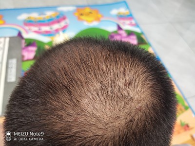 增發(fā)纖維讓我有了底氣