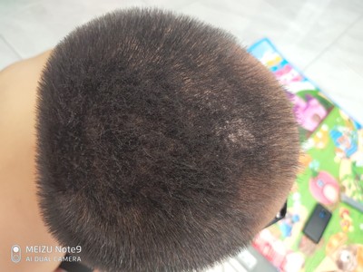 增發(fā)纖維讓我有了底氣