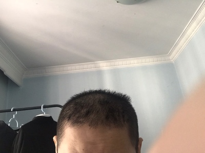 選擇了增發(fā)纖維是我最正確的選擇