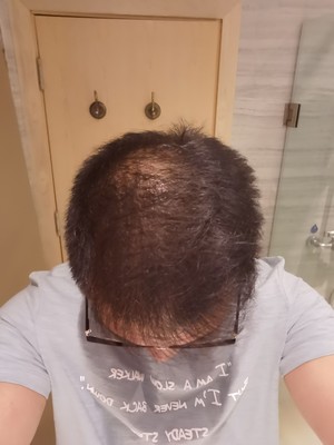 增發(fā)纖維讓我的煩惱消失了