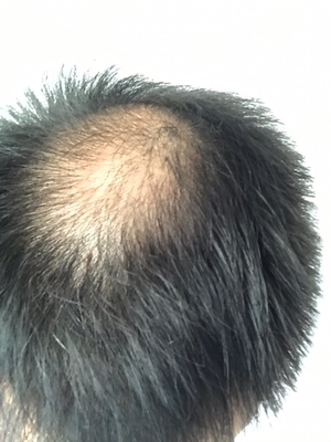 增發(fā)纖維真的好好用