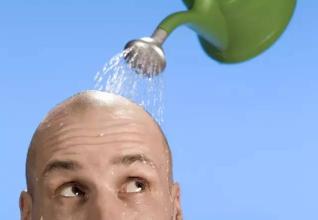 發(fā)際線后移應該怎么辦