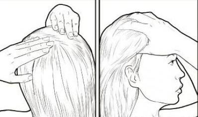 頭皮出油厲害怎么辦