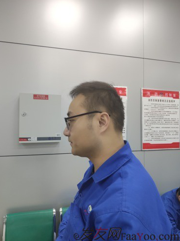 濟(jì)南植發(fā)案例，給你看前后對比圖