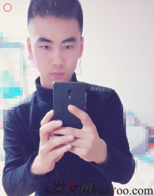 要感謝發(fā)友網(wǎng)我在哈爾濱植發(fā)2500單位