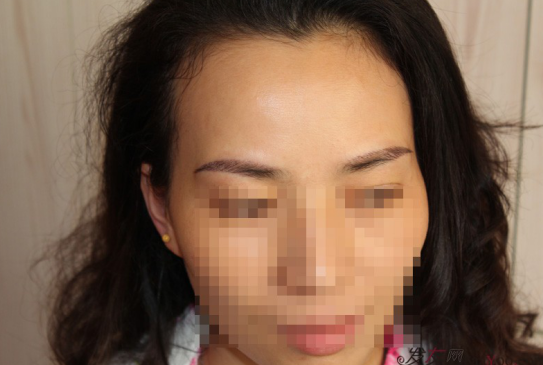 南昌的妹子，種植了眉毛和發(fā)際線，歡迎發(fā)友們圍觀