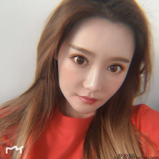 北京南加發(fā)際線調(diào)整案例種植頭發(fā)成功案例