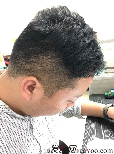 二次植發(fā)，發(fā)現不一樣的自己，植發(fā)記錄貼