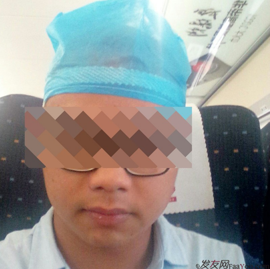 廣州大麥微針1600單位感謝發(fā)友網(wǎng)，記錄一個(gè)真實(shí)