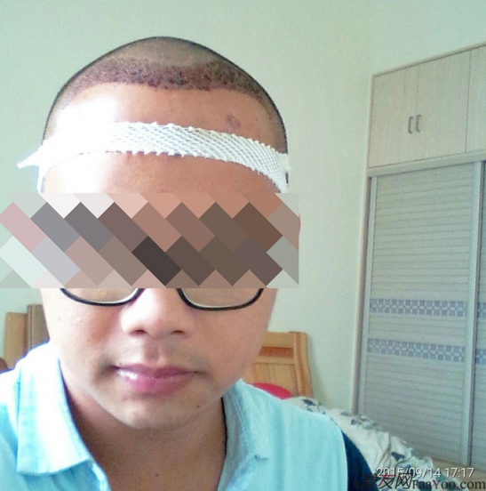 廣州大麥微針1600單位感謝發(fā)友網(wǎng)，記錄一個(gè)真實(shí)