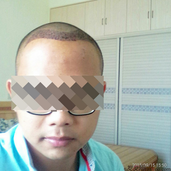 廣州大麥微針1600單位感謝發(fā)友網(wǎng)，記錄一個(gè)真實(shí)