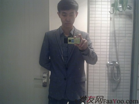 西安大麥微針植發(fā)案例，繼續(xù)看我逆襲蛻變