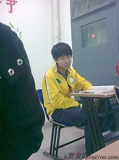 西安大麥微針植發(fā)案例，繼續(xù)看我逆襲蛻變