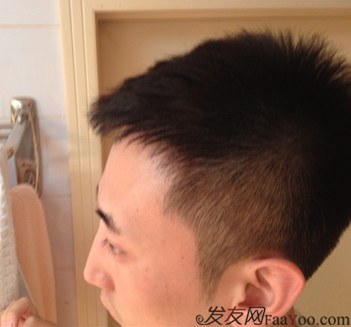 北京植信實(shí)錄發(fā)際線下調(diào)+額角加密2026個(gè)單位