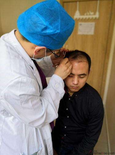 北京南加植發(fā)唐醫(yī)生種植3500單位一年效果恢復(fù)全程記錄