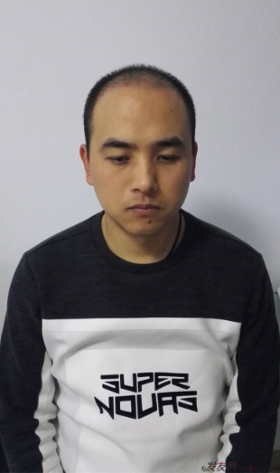 北京南加植發(fā)唐醫(yī)生種植3500單位一年效果恢復(fù)全程記錄