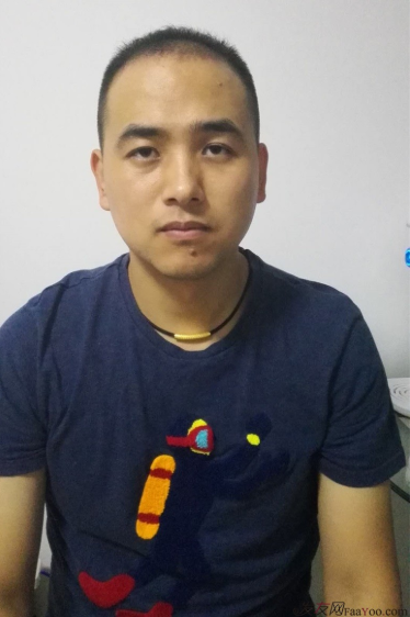 北京南加植發(fā)唐醫(yī)生種植3500單位一年效果恢復(fù)全程記錄