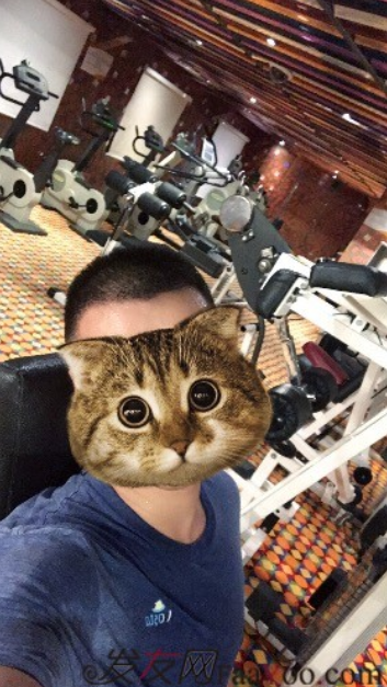 西安大麥微針前額植發(fā)，切勿病急亂投醫(yī)看看我的經(jīng)歷