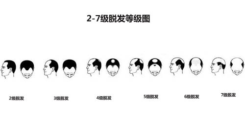 碧蓮盛植發(fā)