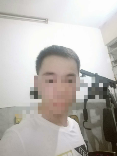 杭州大麥微針植發(fā)2300單位案例，來自脫發(fā)者的內(nèi)心陳述