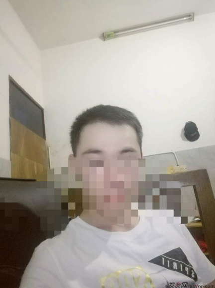 杭州大麥微針植發(fā)2300單位案例，來自脫發(fā)者的內(nèi)心陳述