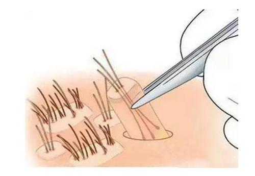 貴陽(yáng)瑞麗詩(shī)頭發(fā)加密的特點(diǎn)是什么