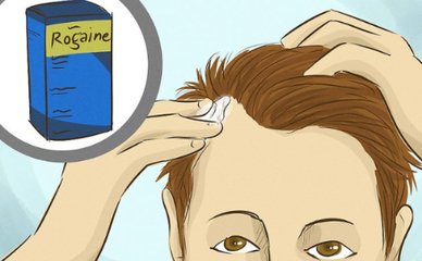 米諾地爾副作用用完后頭油